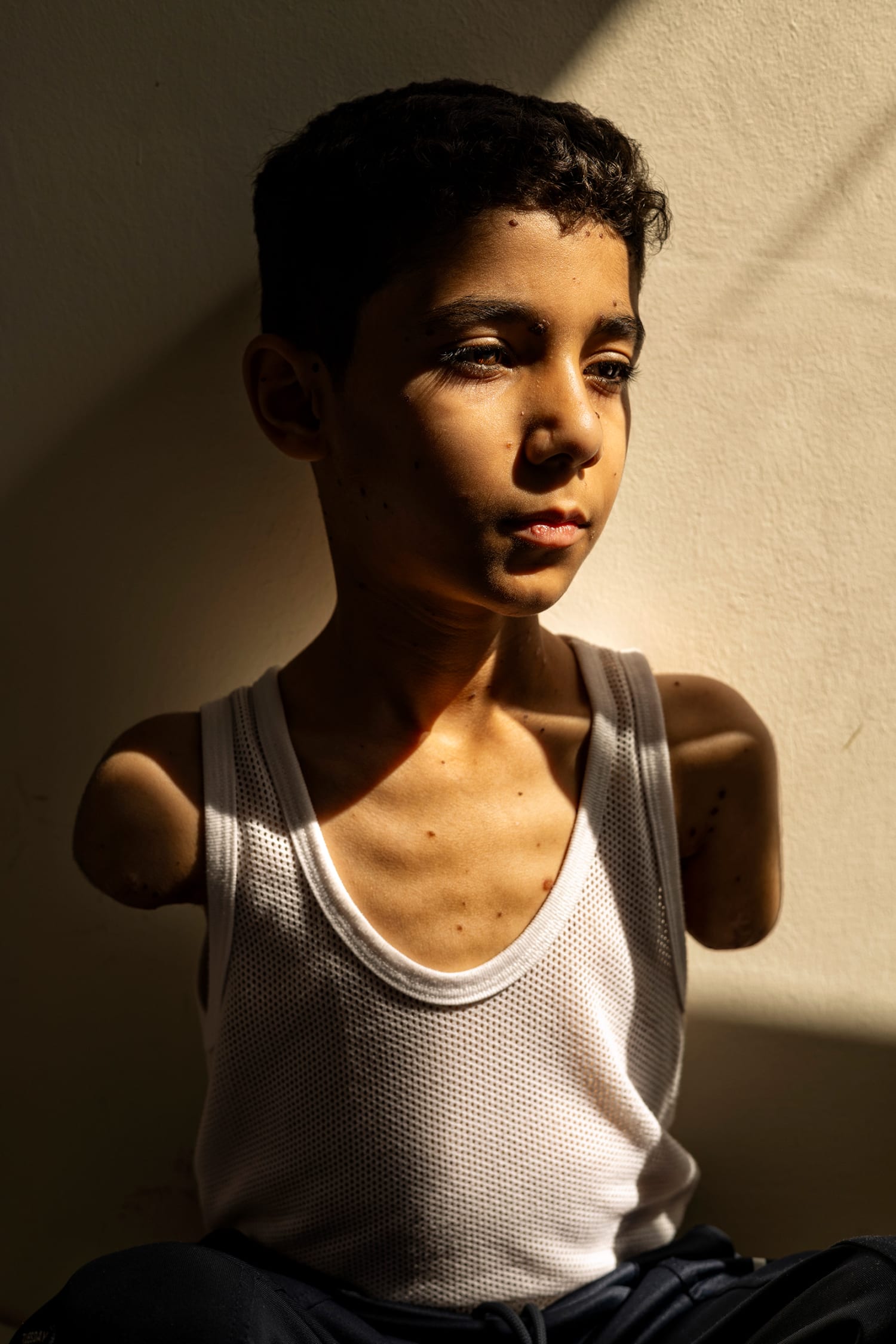 250417-duet-main-Mahmoud-Ajjour-gazan-triple-amputee-ac-810p-587603.jpg