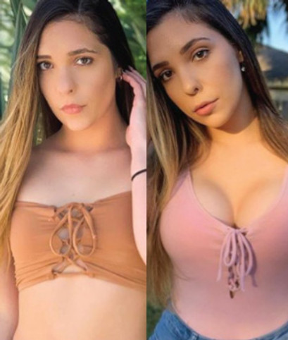 Cost Breast Implants Mexico.jpg
