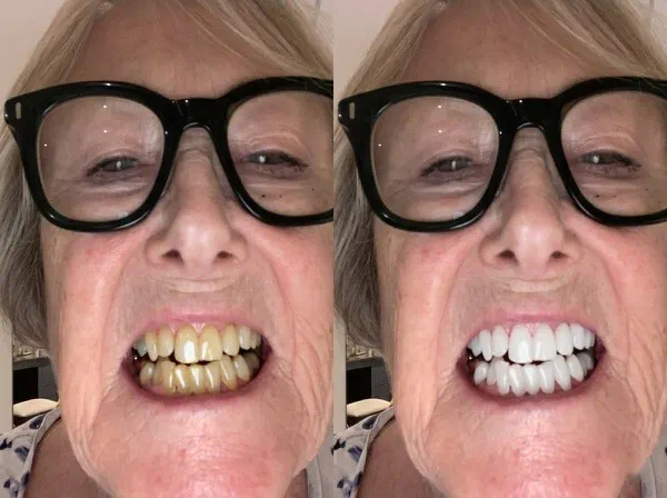 Dimocrat Teef.webp