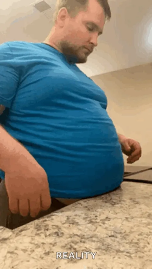 fat-guy-diabetes-surgery-aaontum9amofzv22.webp