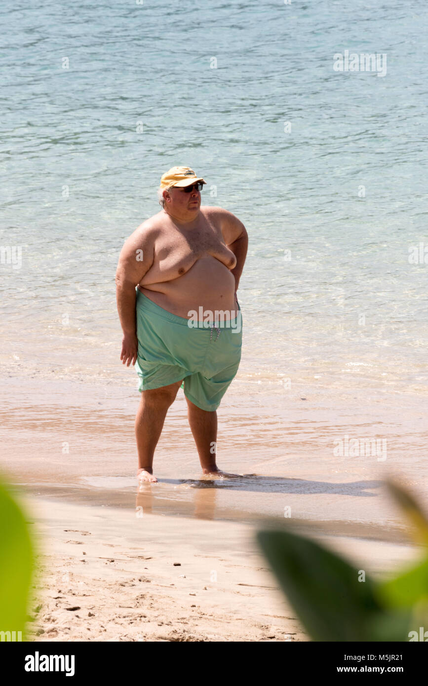 grossly-overweight-man-on-the-beach-M5JR21.jpg