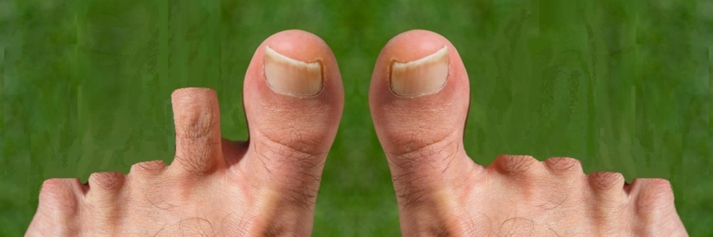 Toe Rating.jpg