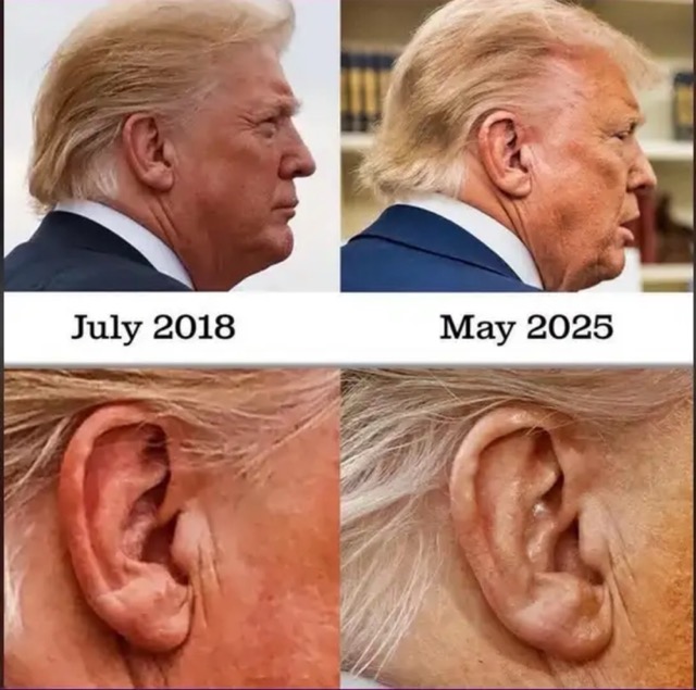 Trump Ear Medium.jpeg