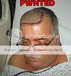 staple-head.jpg